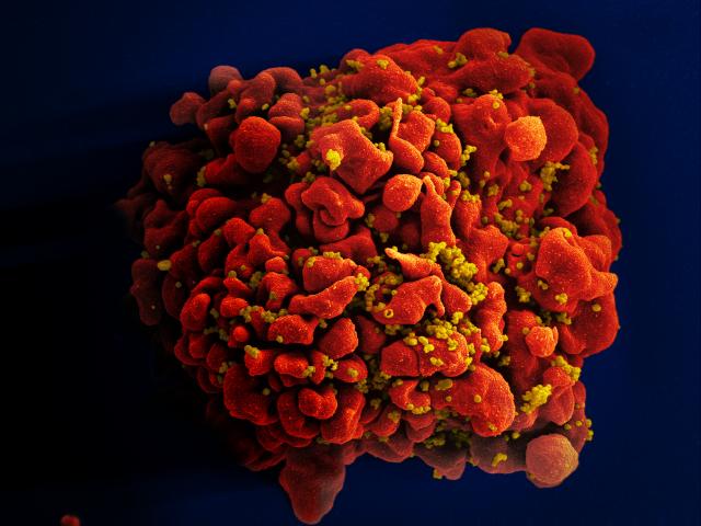 hiv-infisert h9 t-celle